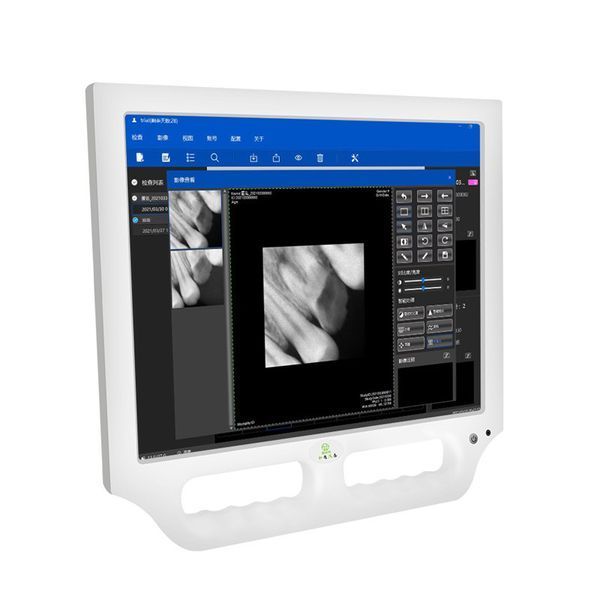 Skydent 17&Prime; TOUCH &mdash; монітор з інтраоральною камерою, сенсорний, Intel E3950, 4 GB RAM, 128 GB SSD, Wi-Fi 2179155032 фото