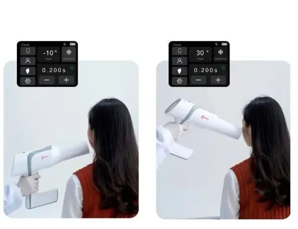 Woodpecker Ai Ray &mdash; портативний стоматологічний рентген, білий Ai Ray фото